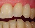 Áttekintés - a fogak csoportosítása és azonosítása